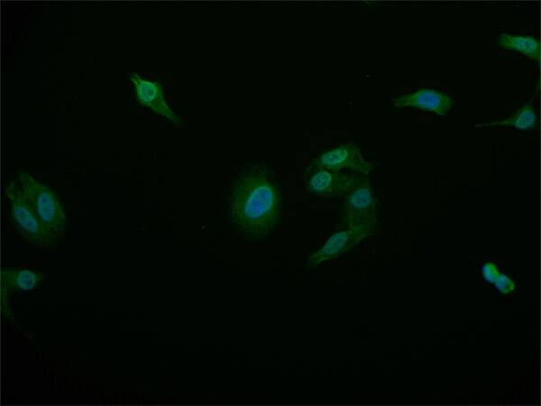 STAT4 Antibody (26G2)