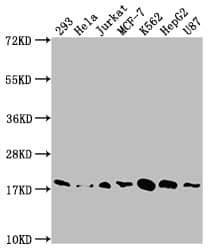 SOD1/Cu-Zn SOD Antibody (3E5)