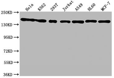 SMC1 Antibody (8C11)