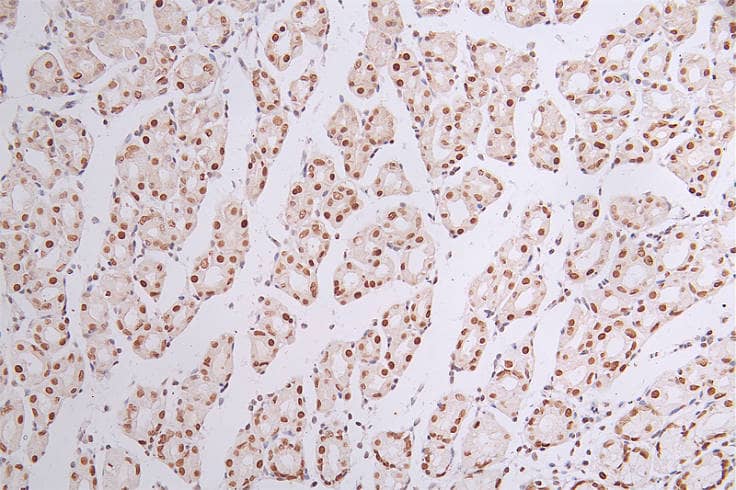 Brg1 Antibody (22F3)