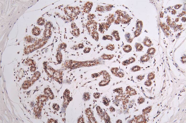 Brg1 Antibody (22F3)