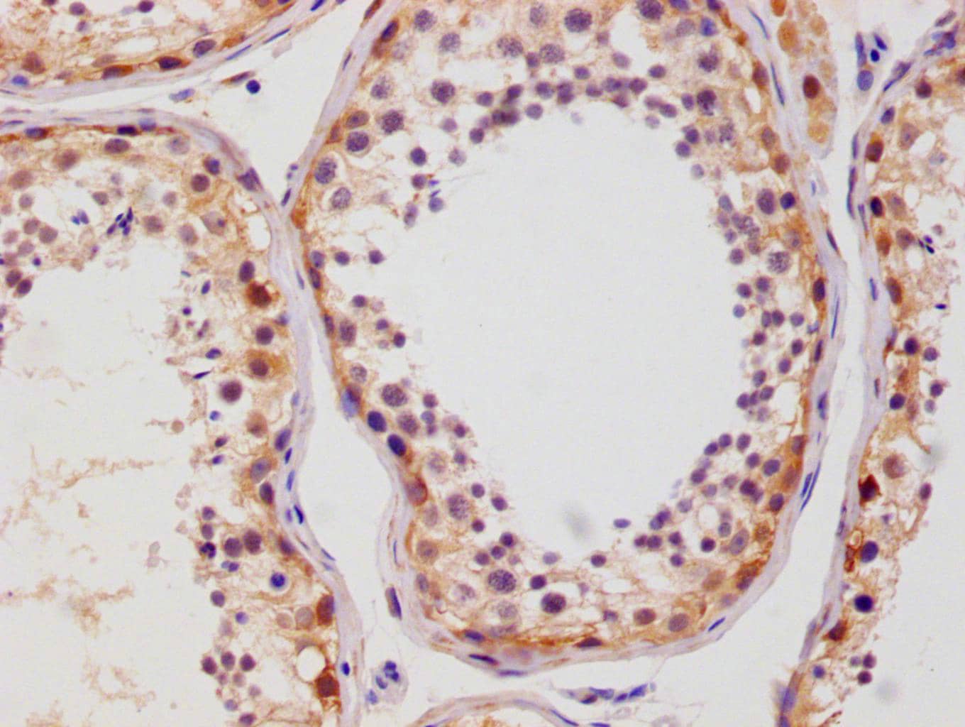 Glut3 Antibody (14B1)