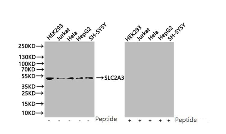 Glut3 Antibody (14B1)