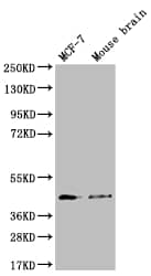 FATP4/SLC27A4 Antibody (11A1)