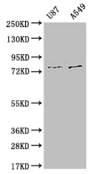 SLC25A12 Antibody (10B12)