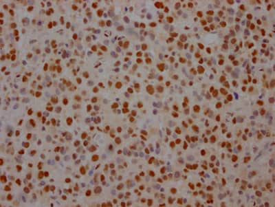 SAP155 Antibody (6C7)