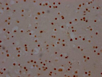 SAP155 Antibody (6C7)