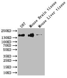 SAP155 Antibody (6C7)