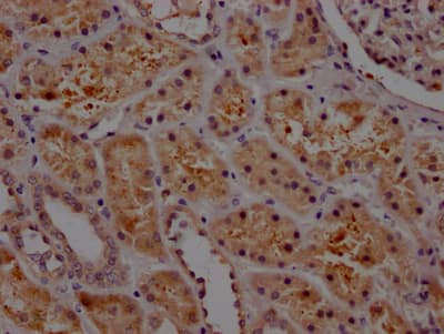 Serpin E1/PAI-1 Antibody (10C3)