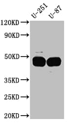 Serpin E1/PAI-1 Antibody (10C3)