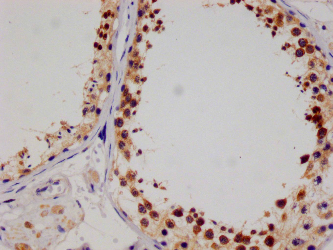 SENP1 Antibody (25H2)