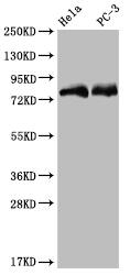 SENP1 Antibody (25H2)