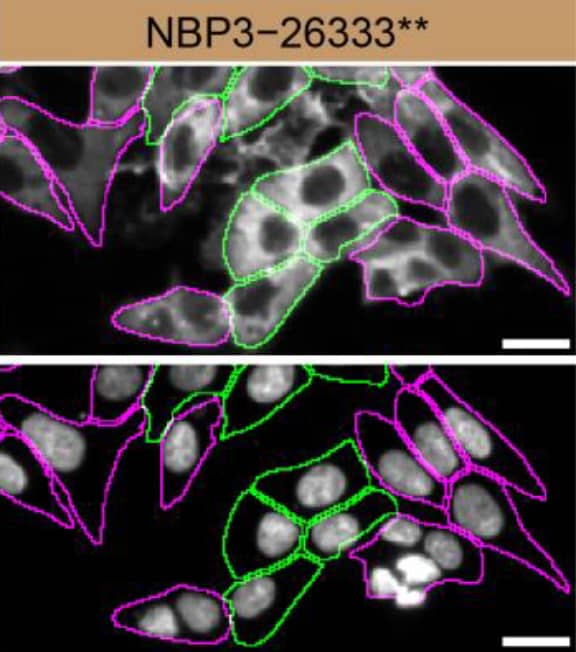 Syntenin 1 Antibody (19C1) - BSA Free Syntenin 1 Specificity is Shown by Immunocytochemistry in Knockdown Cell Line.