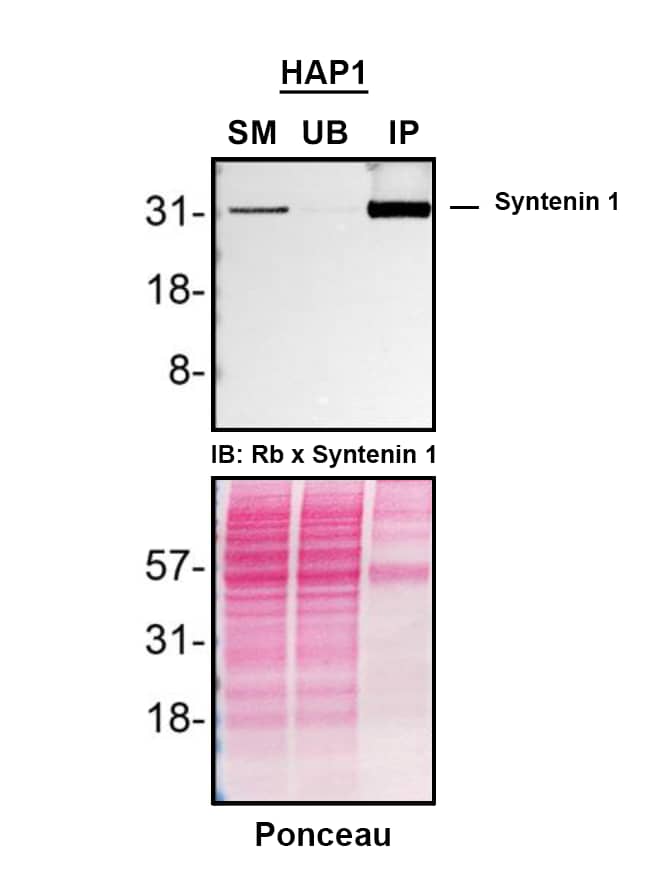 Syntenin 1 Antibody (19C1) - BSA Free Detection of Syntenin 1 by Immunoprecipitation.