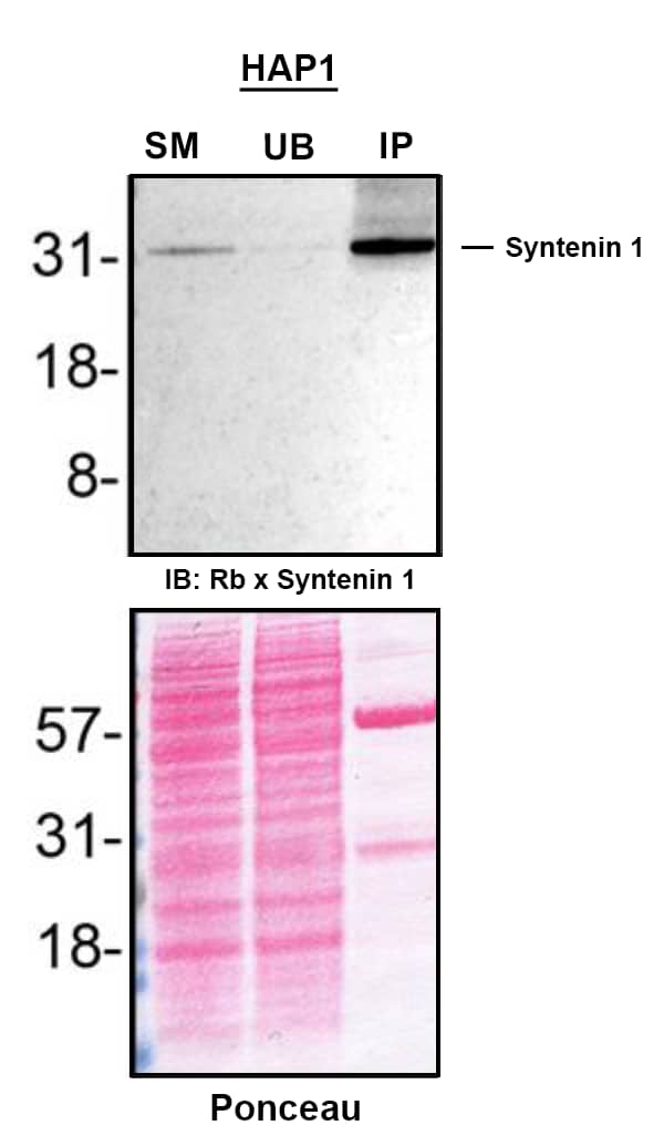 Syntenin 1 Antibody (19C1) - BSA Free Detection of Syntenin 1 by Immunoprecipitation.