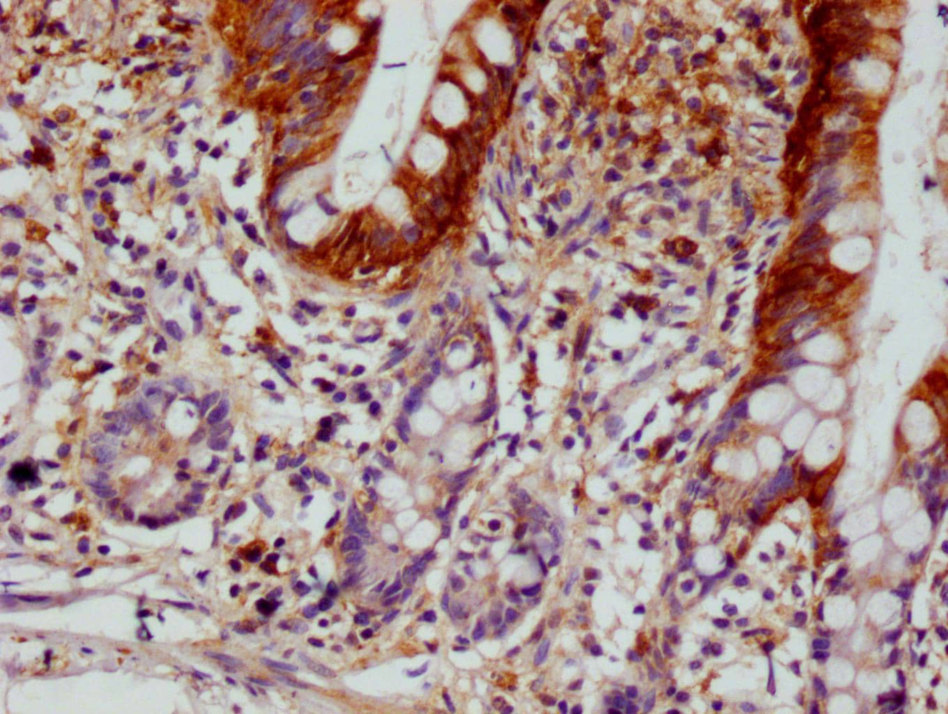 SCIN Antibody (12B11)