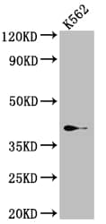 SUMO Activating Enzyme E1 (SAE1) Antibody (9D8)