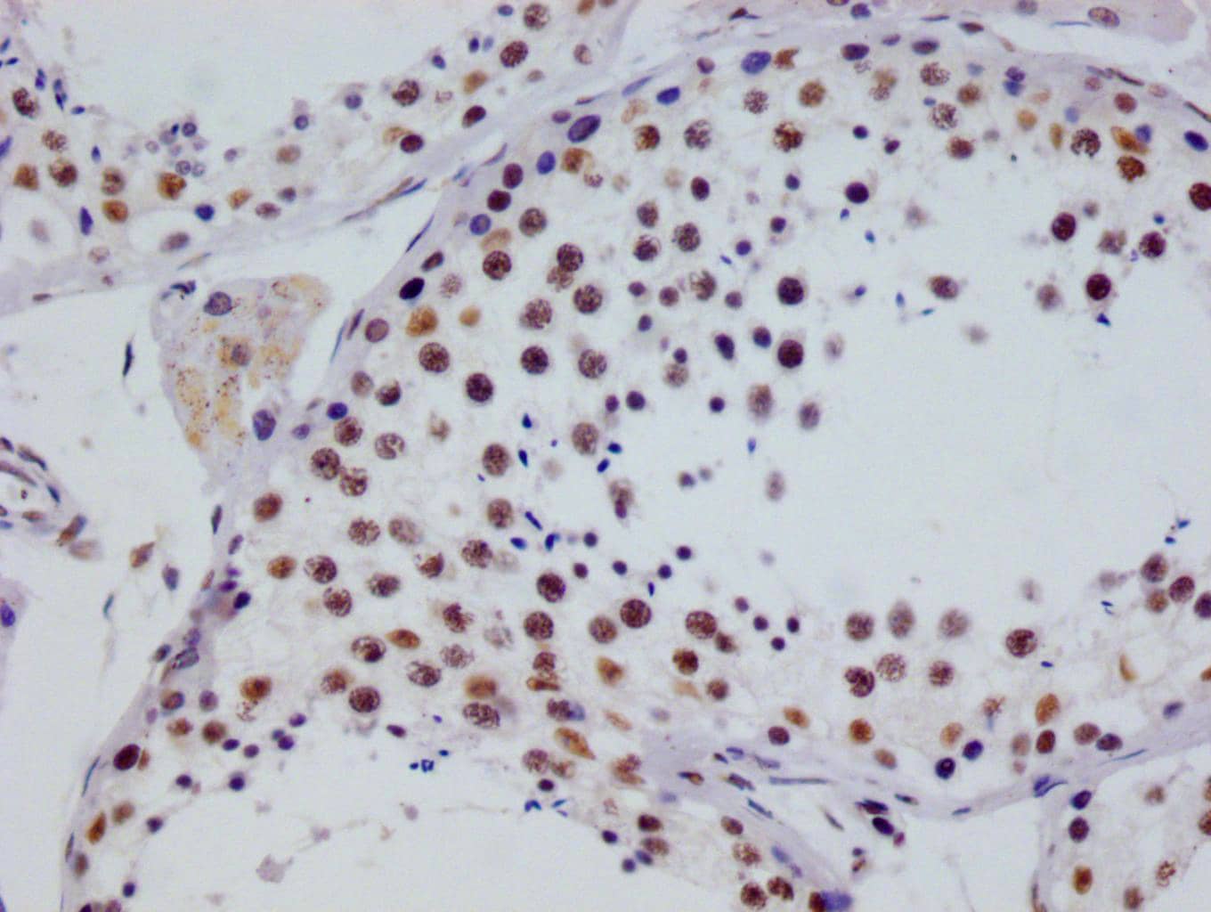 RGS6 Antibody (12H5)