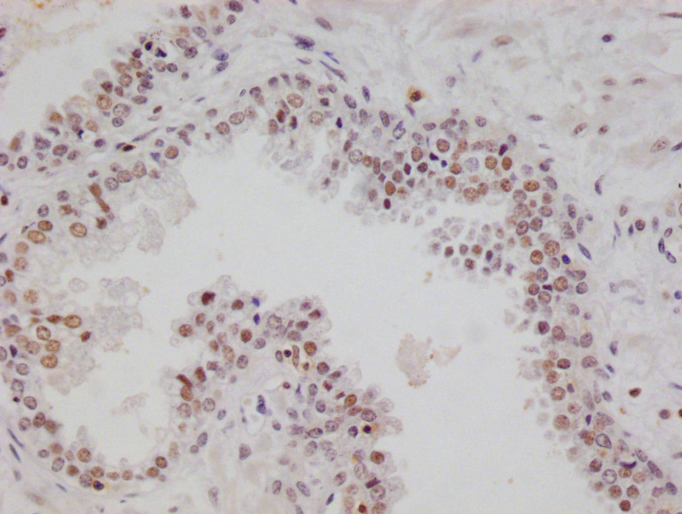RGS6 Antibody (12H5)