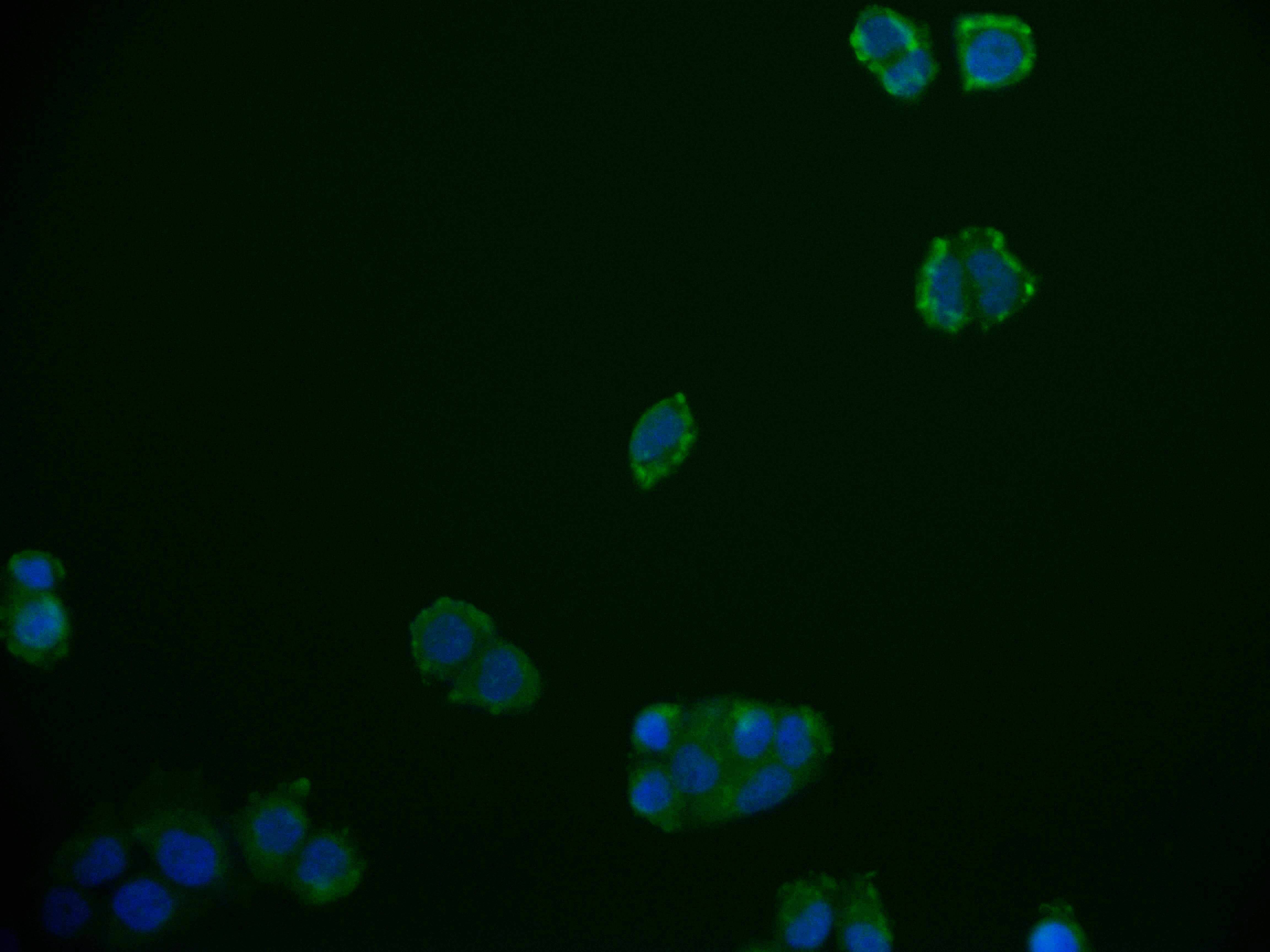 RGS6 Antibody (12H5)