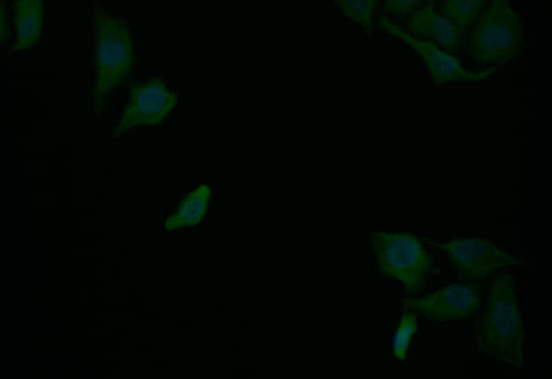 RelB Antibody (9E4)