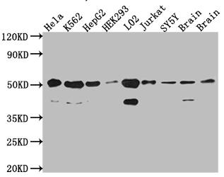 RBBP4/RbAp48 Antibody (3E9)
