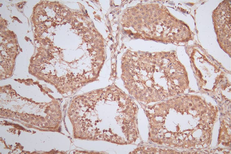 Ran Antibody (15A8)