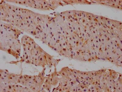 SHP-2/PTPN11 Antibody (6G11)