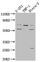 PTH1R/PTHR1 Antibody (1G7)