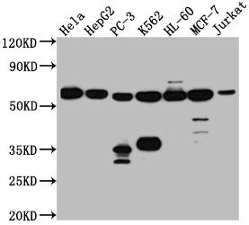PTBP1 Antibody (8A1)