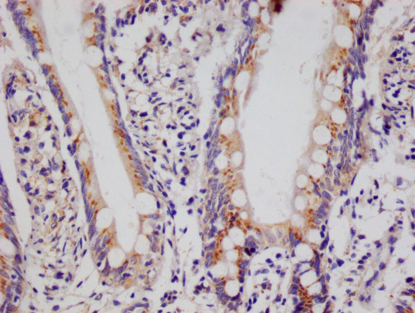 PA28 Activator alpha Subunit/PSME1 Antibody (29D5)