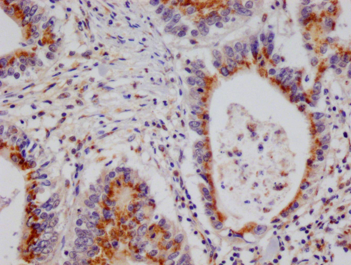 PA28 Activator alpha Subunit/PSME1 Antibody (29D5)