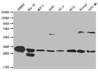 PA28 Activator alpha Subunit/PSME1 Antibody (29D5)