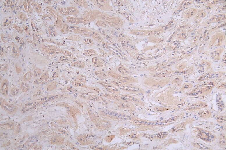 Protein Kinase A Regulatory Subunit II alpha Antibody (15G8)