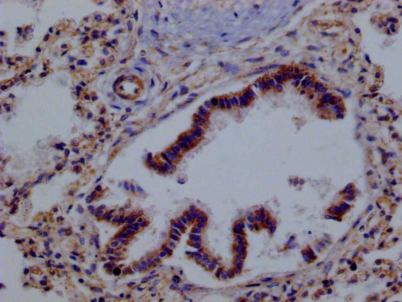 Peroxiredoxin 3 Antibody (14E2)