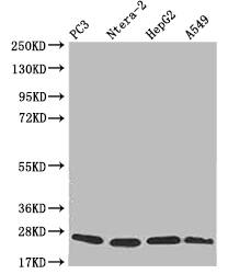 Peroxiredoxin 3 Antibody (14E2)