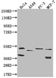 TAPP1/PLEKHA1 Antibody (16C9)