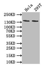 PKN2 Antibody (11H3)