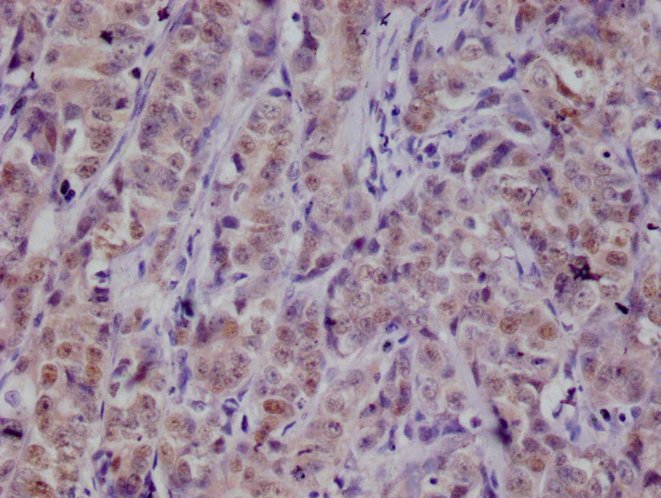 PKN2 Antibody (20A8)