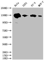 PKN2 Antibody (20A8)