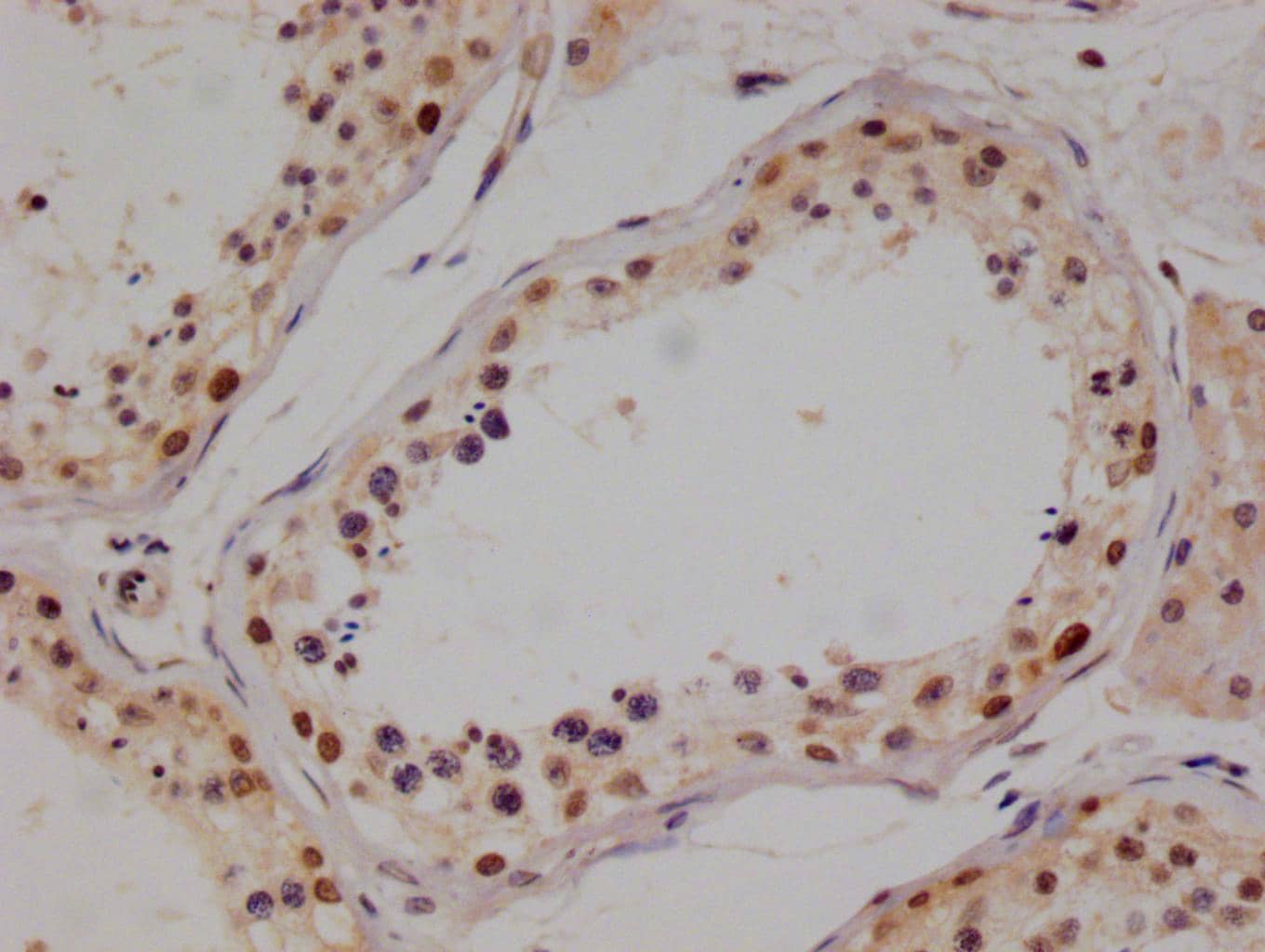 PIN4 Antibody (14A7)