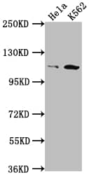 PI 3-Kinase p110 beta/PIK3CB Antibody (5A9)