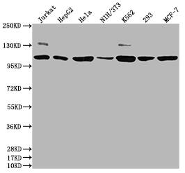 PIK3CA Antibody (10E5)