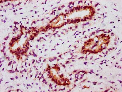 STAT5A [p Tyr694] Antibody (3F1)