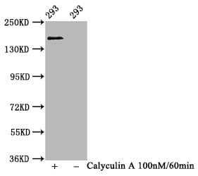 SMC1 [p Ser957] Antibody (1F9)