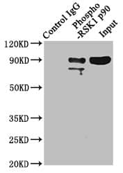 RSK1 [p Thr359, p Ser363] Antibody (1B6)