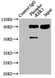 RSK1 [p Ser380] Antibody (1E11)