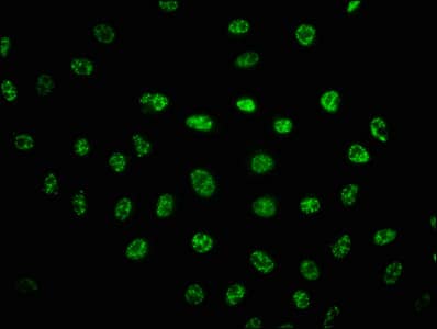 DNA-PKcs [p Ser2056] Antibody (4A4)