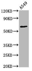 PKC zeta [p Thr560] Antibody (1B10)