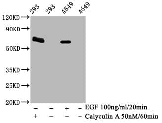 AMPK alpha 2 [p Thr172] Antibody (4F4)